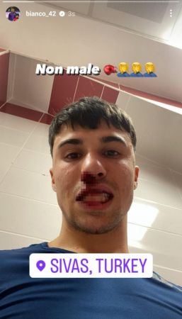 Fiorentinalı futbolcunun burnunu kıran taraftar adliyeye sevk edildi