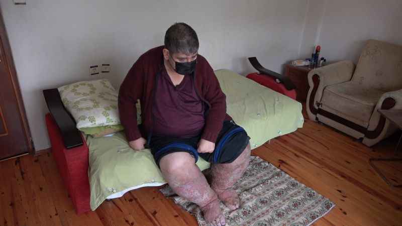 Sivrisineğin ısırdığı güvenlik görevlisi İbrahim Kadir Karaoğlanoğlu hayatını kaybetti