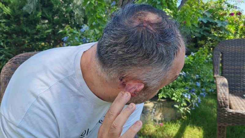 Spor yorumcusu ve işletmeci Levent Bulut öldüresiye dövülüp gasp edildi