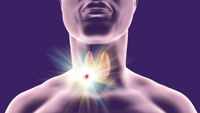 Nodülün boyutu 4 cm'den fazlaysa dikkat!