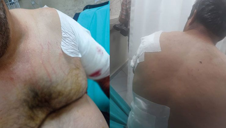 Ayı vatandaşa saldırdı, köylüler korku içinde