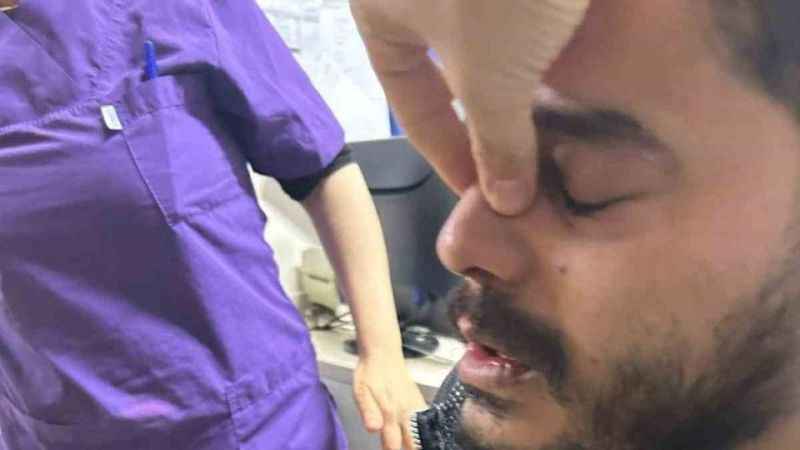 Gaziantep’te hasta yakınları tarafından darp edilen doktorun burnu kırıldı