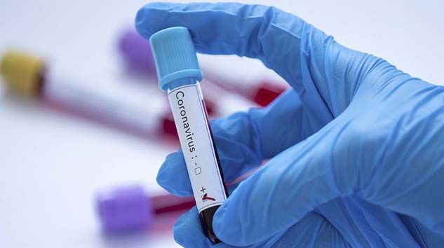 Kan grubu A olanlarda Kovid-19 görülme olasılığı daha yüksek