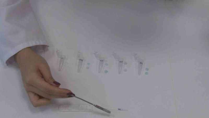 Genç girişimciler ‘Diş Çürükleri Erken Tanı Kiti’ projesini hayata geçirmeyi hedefliyor