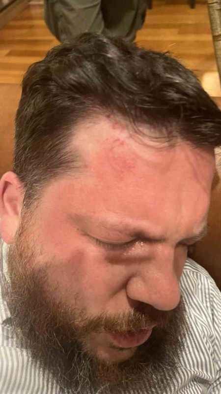 Rusya’da ölen muhalif lider Navalny’nin Litvanya’daki yardımcısına çekiçli saldırı