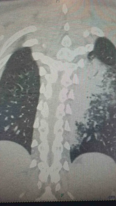 Türkiye’de yeni salgın alarm veriyor