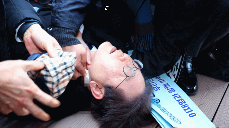  Güney Kore ana muhalefet lideri saldırıya uğradı