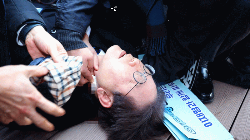  Güney Kore ana muhalefet lideri saldırıya uğradı