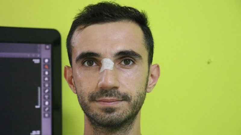 Şah kartalı, pençe darbesiyle veterineri yaraladı