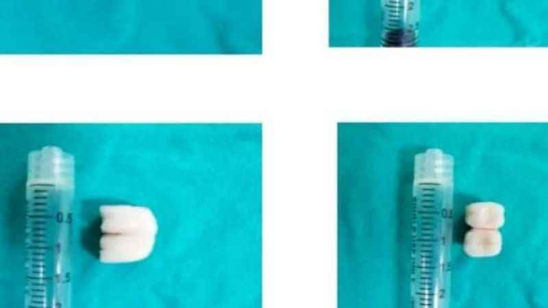 Diş tedavisi için gitti canından oluyordu