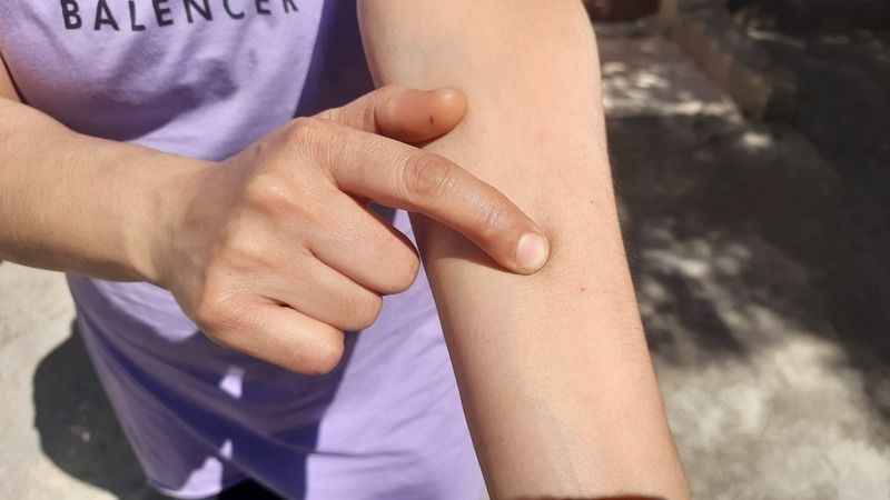 Böcekler, önce evlerini sonra vücutlarını istila etti