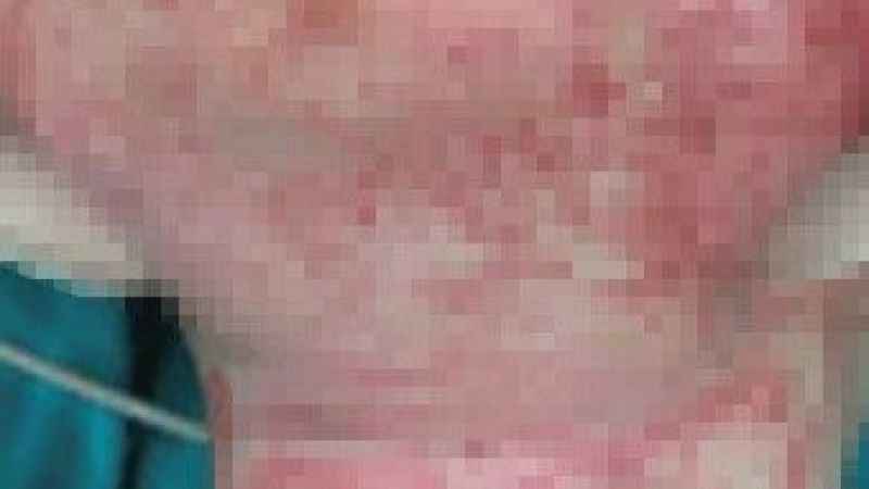 Sosyal medya çocukların hayatını da karartıyor