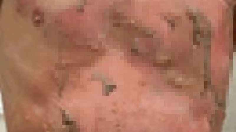 Sosyal medya çocukların hayatını da karartıyor