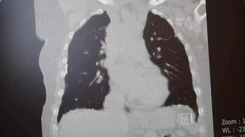 Gazze'de 'fosfor ve asbest' tehlikesine dikkat