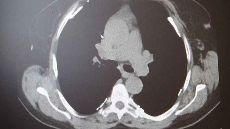 Gazze'de 'fosfor ve asbest' tehlikesine dikkat