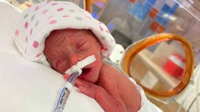 500 gram doğmuştu, 90 gün sonra sağlığına kavuştu