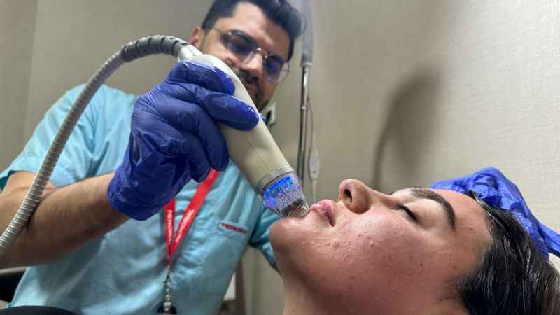 Altın iğne tedavisi ile gelen güzellik