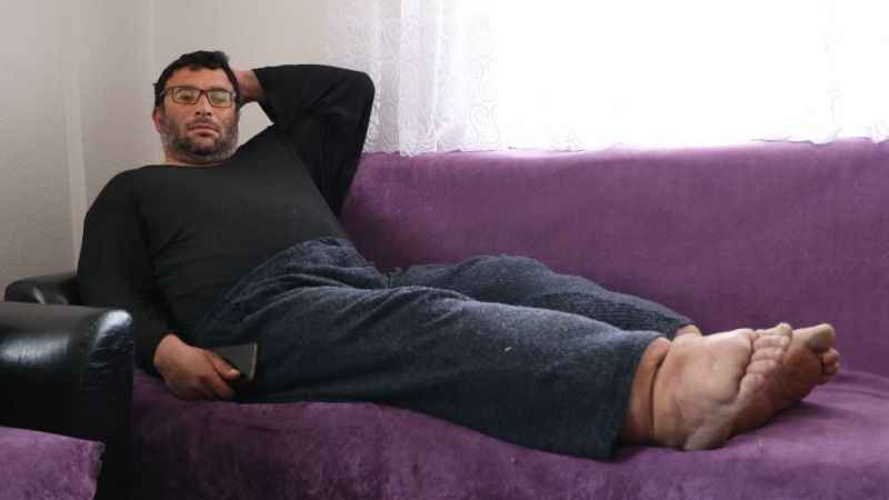 80 santimetre çapına ulaşan bacaklarına çare arıyor