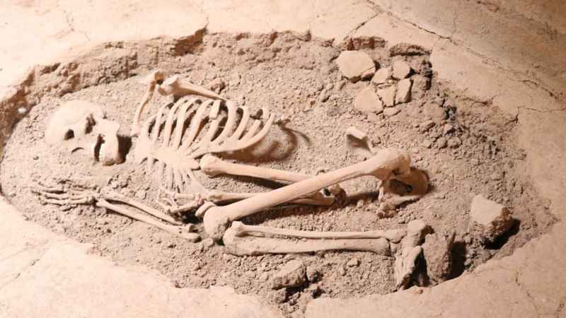 Dünyanın ilk beyin ameliyatı bu kafatasına yapıldı!