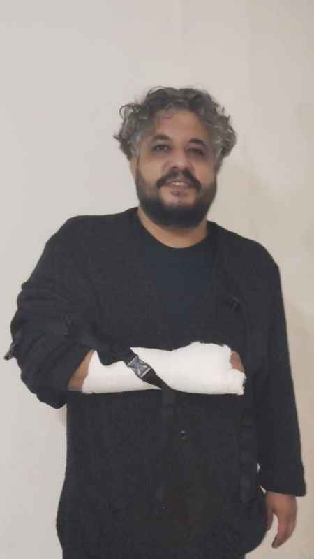 Tiyatro sahnesinde elini kırdı ama oyuna devam etti