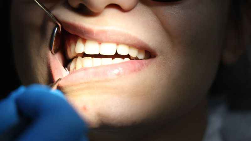 Diş gıcırdatanlar dikkat !