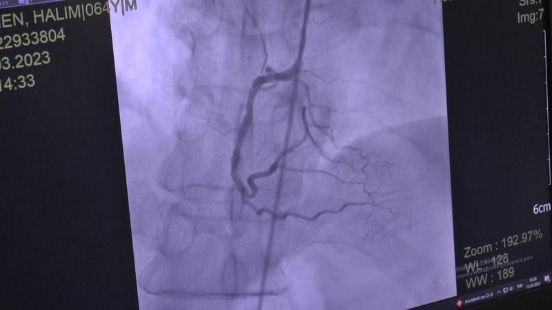 Hipertansiyon Hastalarına ‘Oruç’ Uyarısı