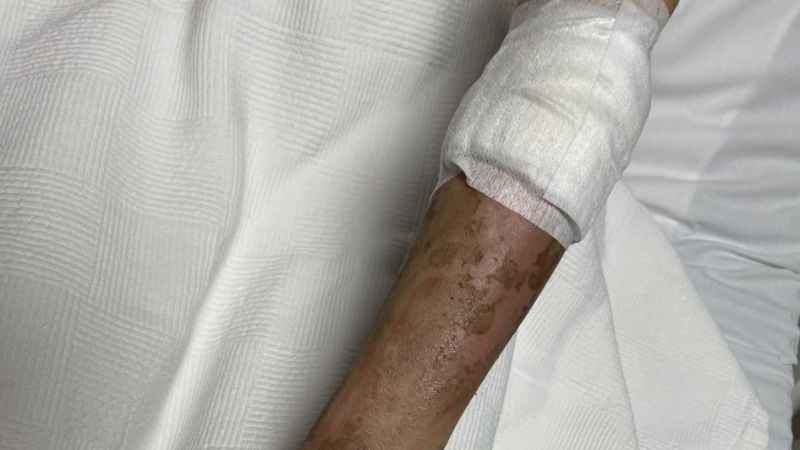 Lavabo açıcı bomba gibi patladı