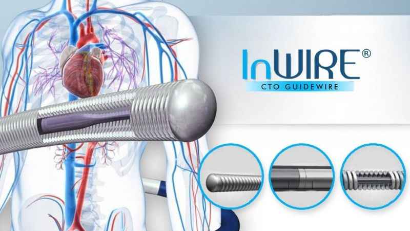 Kalp damarları tam tıkalı da olsa çözümü var