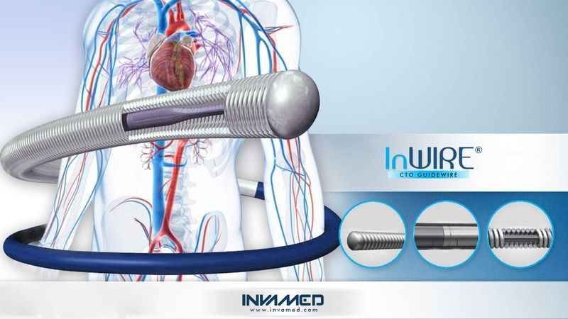 Kalp damarları tam tıkalı da olsa çözümü var