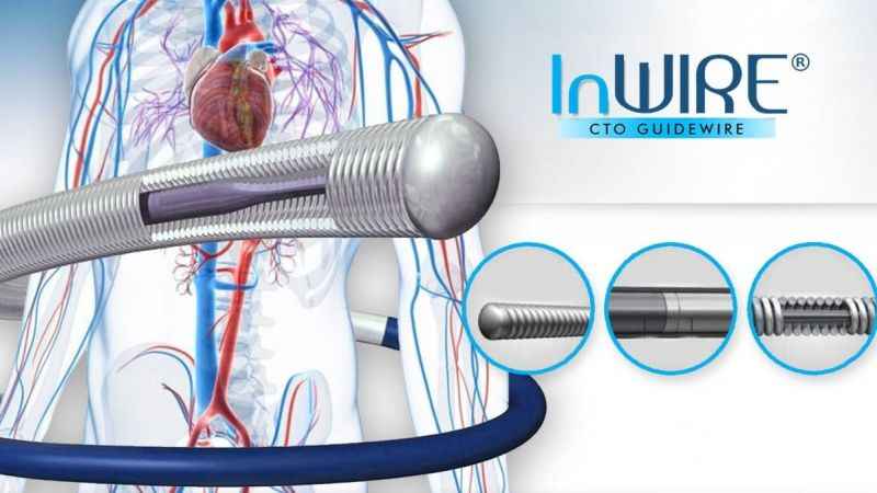 Kalp damarları tam tıkalı da olsa çözümü var