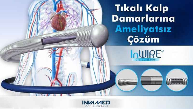 Kalp damarları tam tıkalı da olsa çözümü var