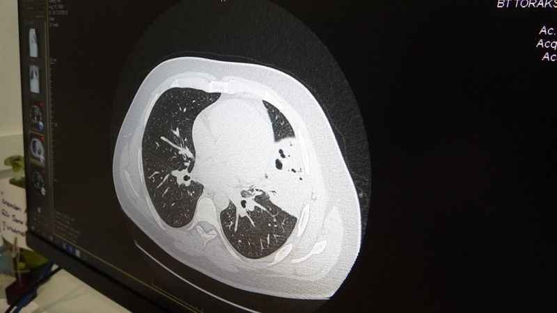 Sıcaklık değişimleri virüsleri artırdı