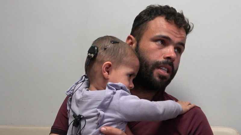 Biyonik kulak ile duymaya başladılar