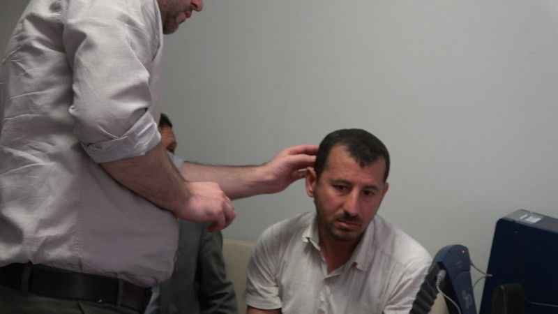 Biyonik kulak ile duymaya başladılar