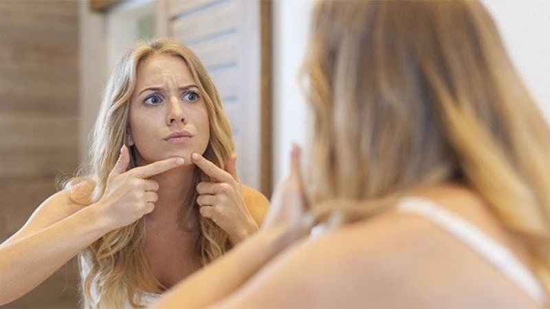 Sivilce sadece ergenlerin sorunu değil