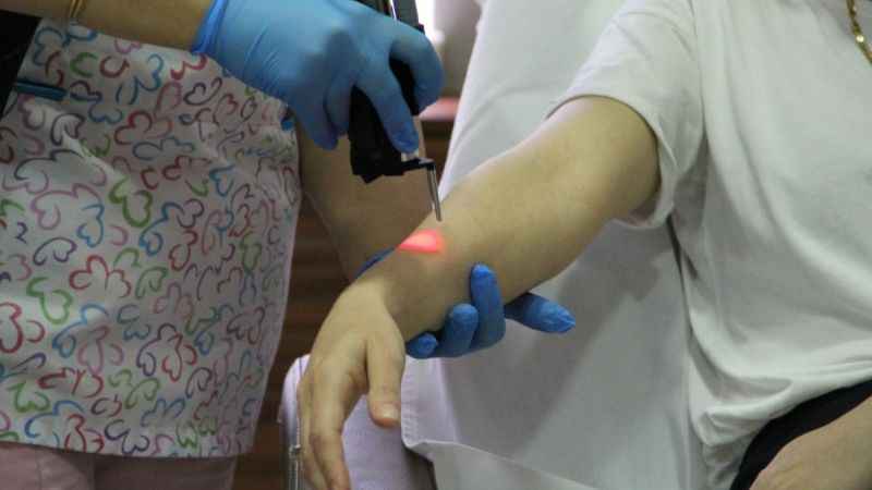 Merdiven altı lazer epilasyona dikkat!