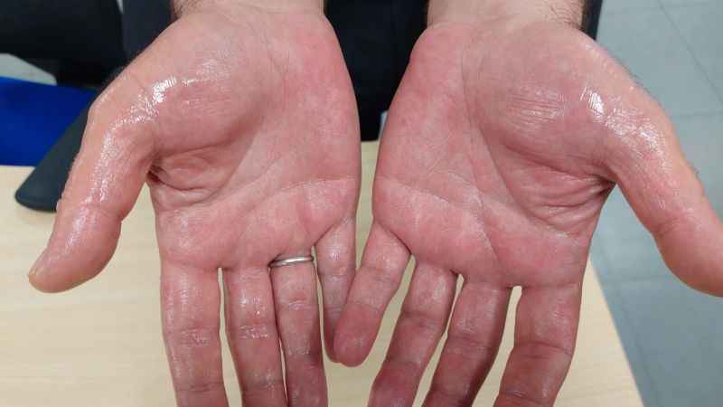 Terlemeye terletmeyen çözüm