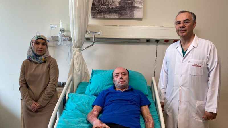 140 ameliyat geçirdi 8 ay hastanede kaldı