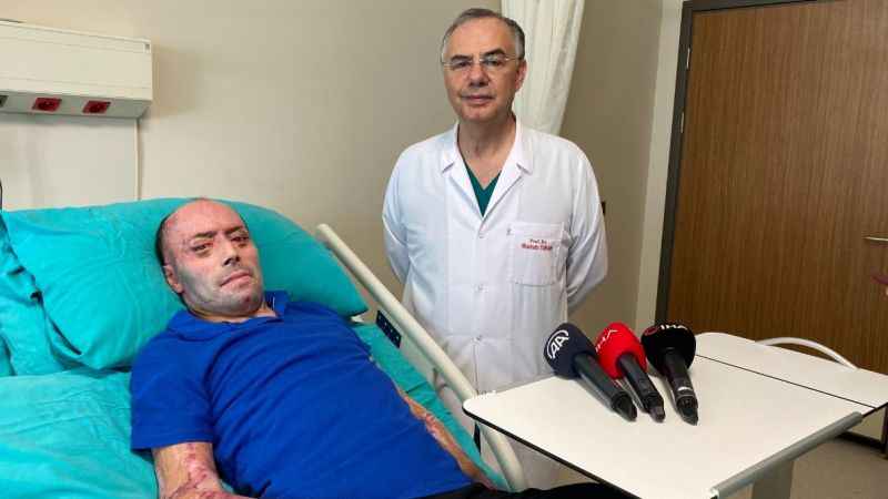 140 ameliyat geçirdi 8 ay hastanede kaldı