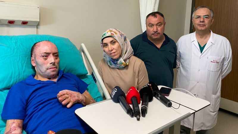 140 ameliyat geçirdi 8 ay hastanede kaldı