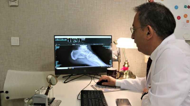 Topuk dikenine dakikalar içerisinde çözüm