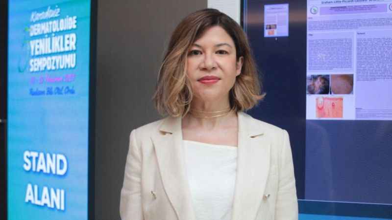 Sedef, artık tedavisi olan bir hastalık