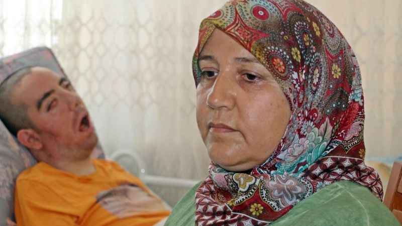 Doktorlar 6 ay ömür biçti, 10 yıldır gözlerini bir an olsun kırpmadan yaşam savaşı veriyor