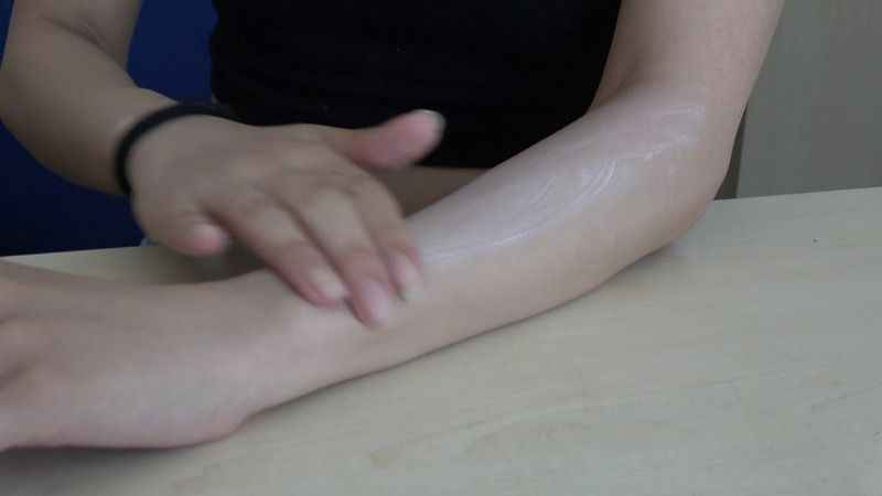 Güneş yanıklarına evde tedavi uygulamayın