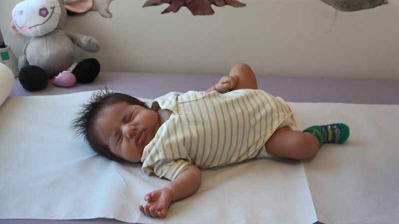 Yemek borusu olmadan doğan bebeğe müdahale