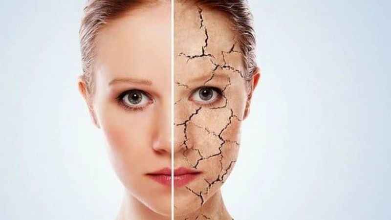 Kış aylarında deri hastalıklarında artış olabilir