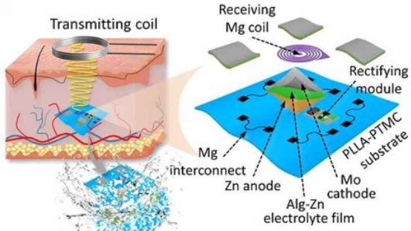 Deri altına yerleştirilebilecek kablosuz şarj cihazı geliştirildi