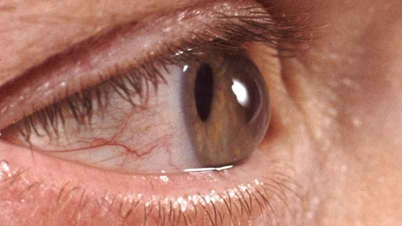 Sonbaharda göz sağlığını korumak için bunlara dikkat!