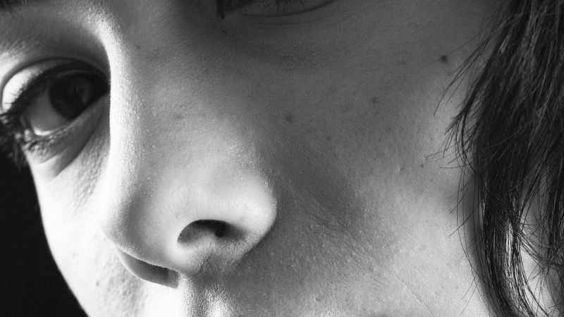 Burun ameliyatı olacaklar, dikkat!