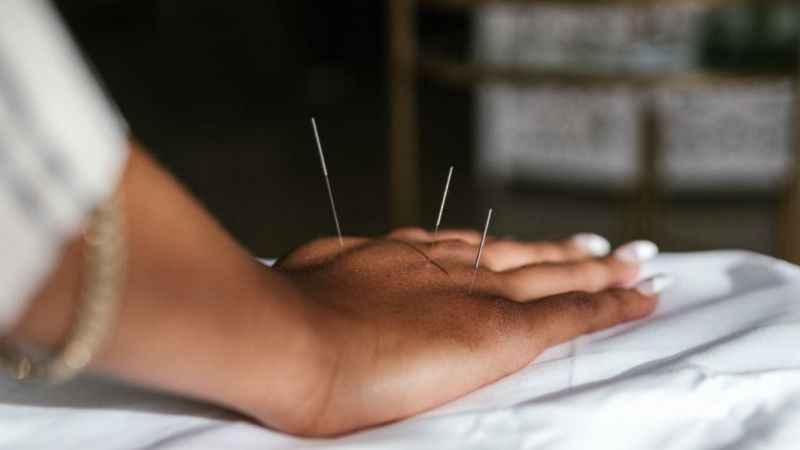 Vücudun gizli eczanesi: Akupunktur